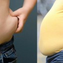10 Natural Ways For Treating Obesity