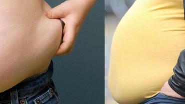 10 Natural Ways For Treating Obesity