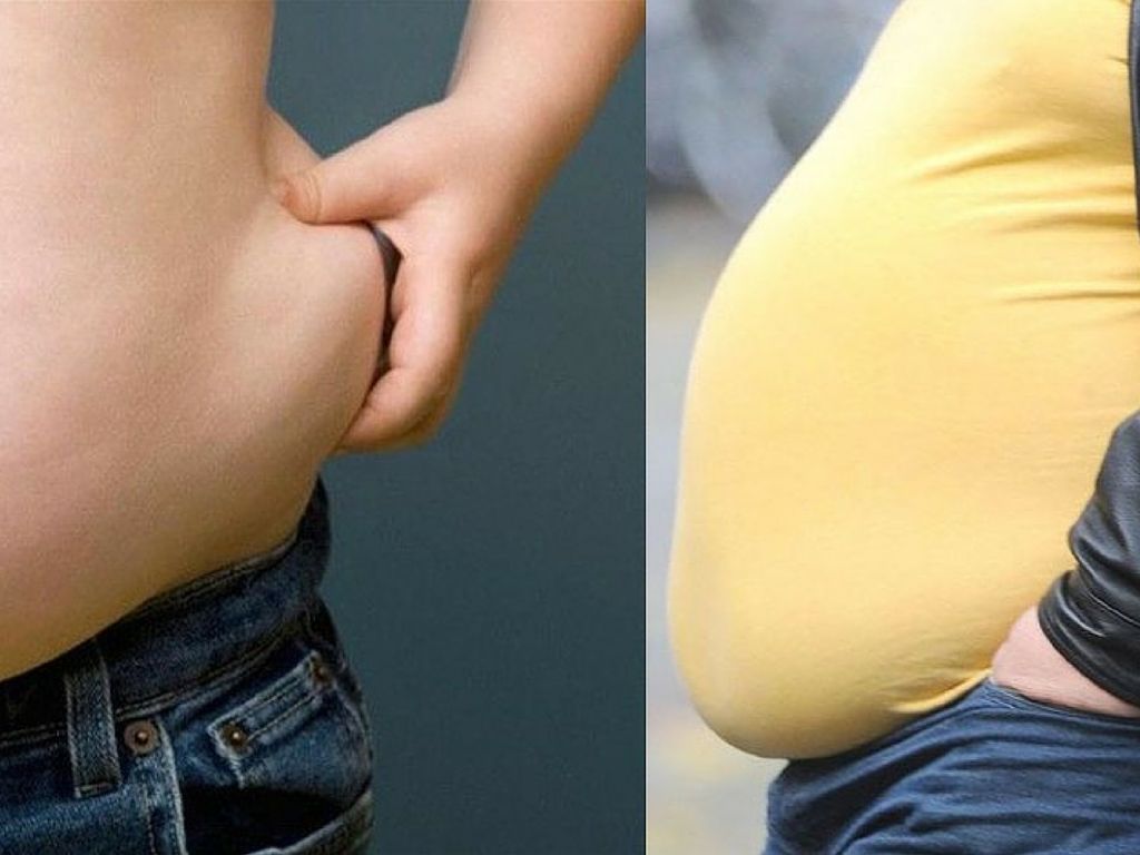 Natural Ways For Treating Obesity