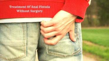 Treatment of Anal Fistula Without Surgery