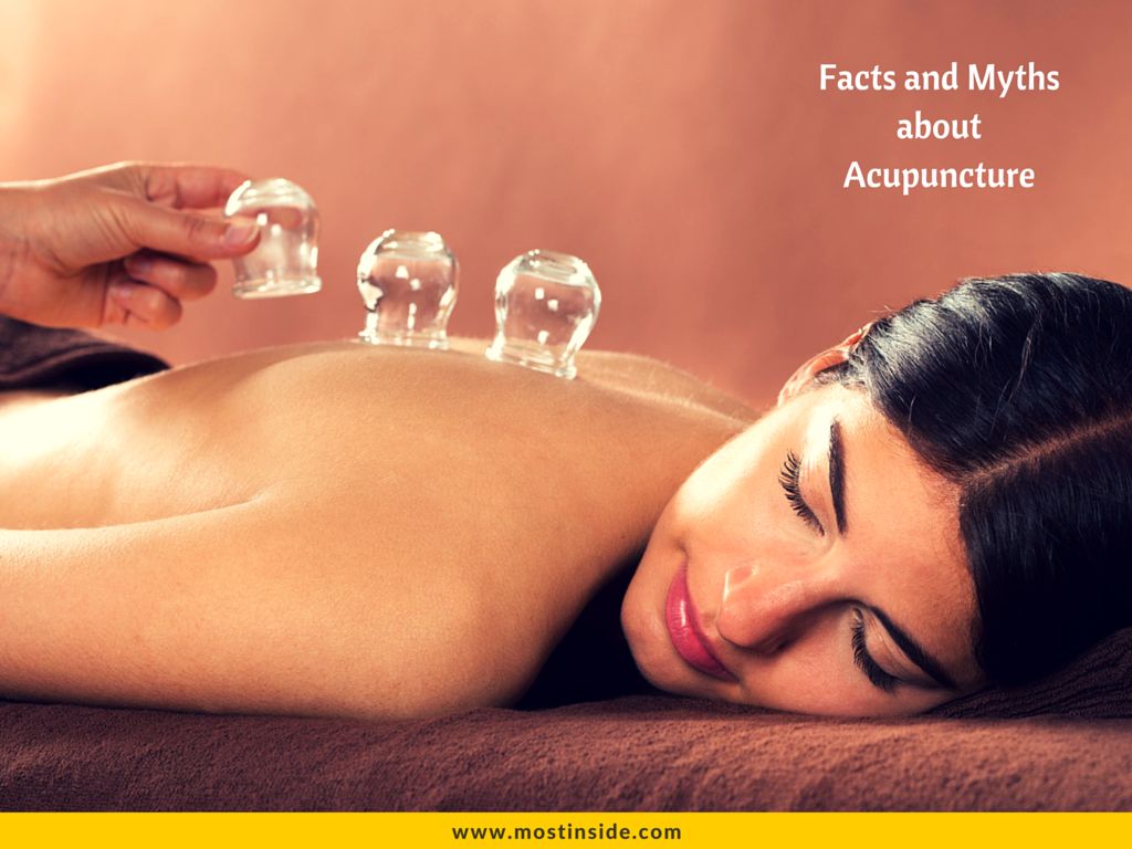 Acupuncture Myths