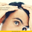 Pros and Cons About Hair Transplant