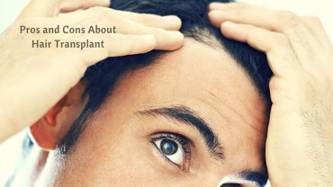 Pros and Cons About Hair Transplant