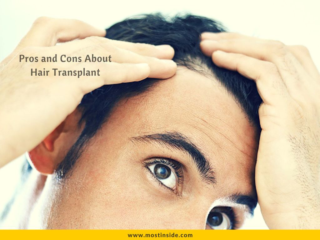 Hair Transplant Pros