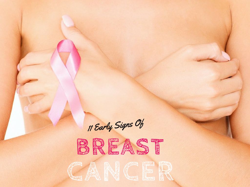 early signs of Breast Cancer