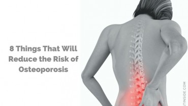 8 Things That Will Reduce the Risk of Osteoporosis