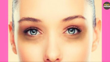 11 Major Causes Of Dark Circles