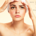 How To Use Castor Oil For Acne Treatment?