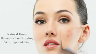 Natural Home Remedies For Treating Skin Pigmentation