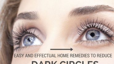 Easy and Effectual Home Remedies to Reduce Dark Circles