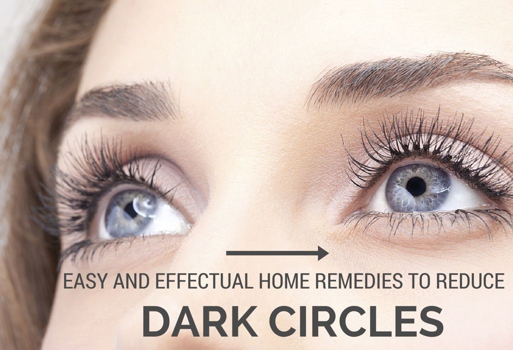 Home Remedies Dark Circles