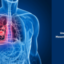 Understanding Mesothelioma Cancer