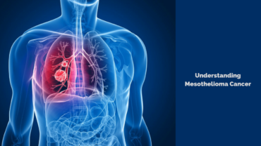 Understanding Mesothelioma Cancer