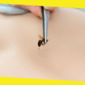 Prevention And Home Remedies For Bee Stings