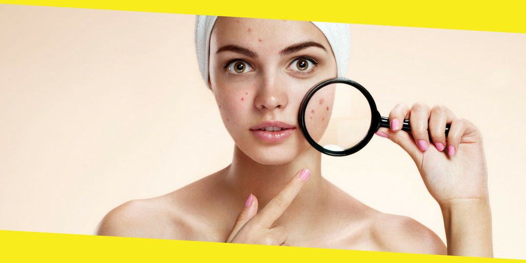 Pimple Cure Best Tips