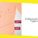 A Discourse on the Various Types of Hernia