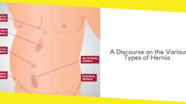 A Discourse on the Various Types of Hernia