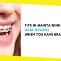 Tips in Maintaining Oral Hygiene When You Have Braces