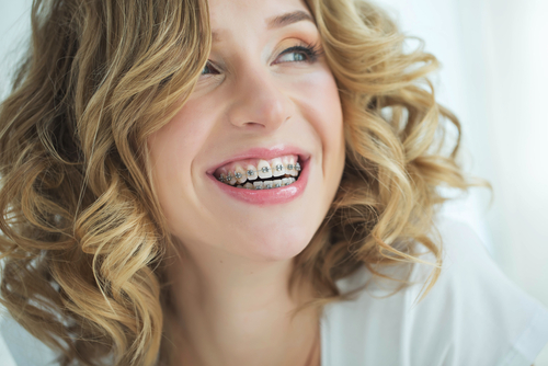 Tips in Maintaining Oral Hygiene When You Have Braces