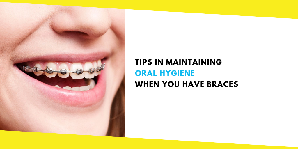 How do you maintain oral hygiene when you have braces