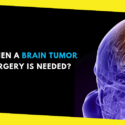 How to Know When a Brain Tumor Surgery is Needed?