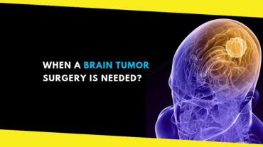How to Know When a Brain Tumor Surgery is Needed?