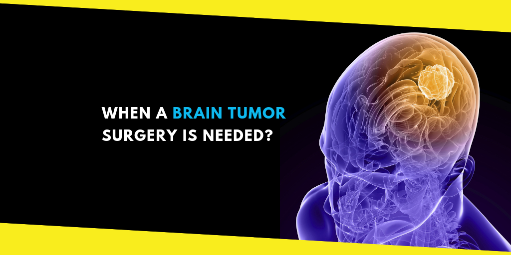 Brain Tumor Surgery