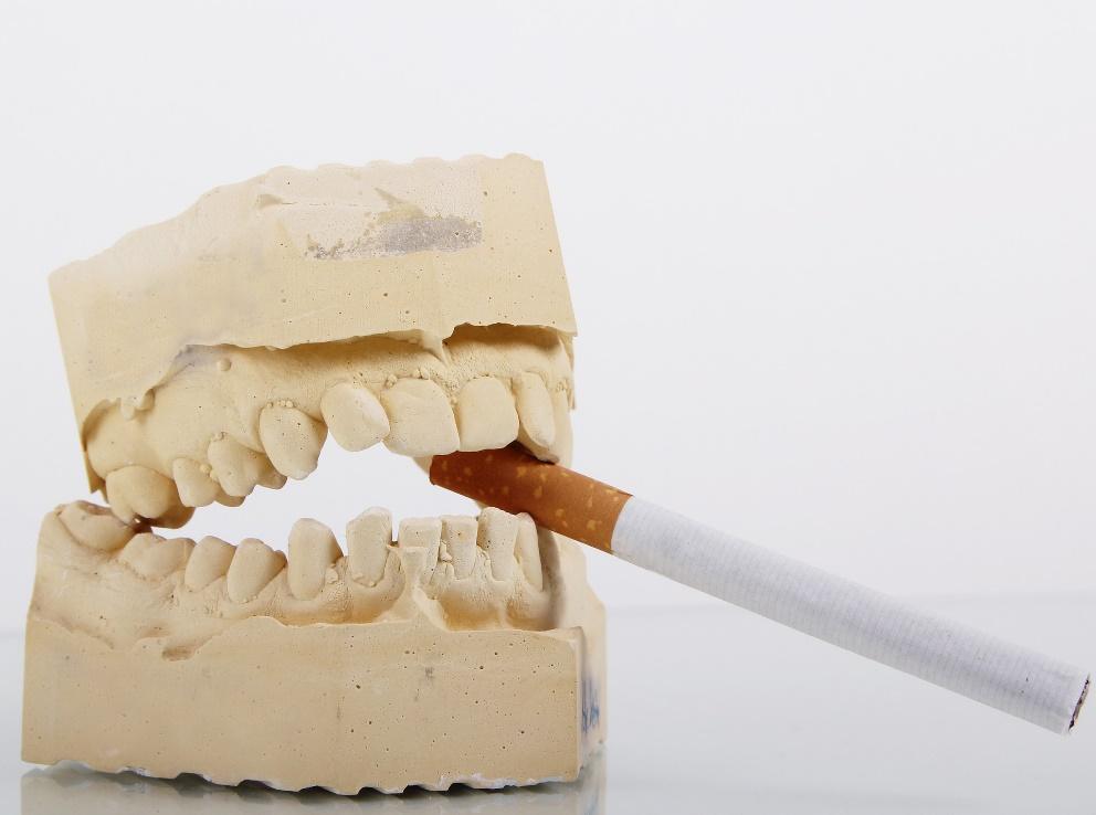 Why is Smoking a Big No for Your Dental Health