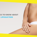 9 Things to Know About Liposuction