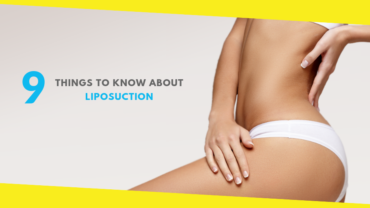 9 Things to Know About Liposuction