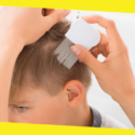 A Definitive Guide for Lice Treatment and Diagnosis