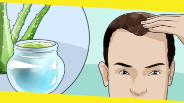 Indian Remedies for Men’s Hair-fall Hair-loss Baldness