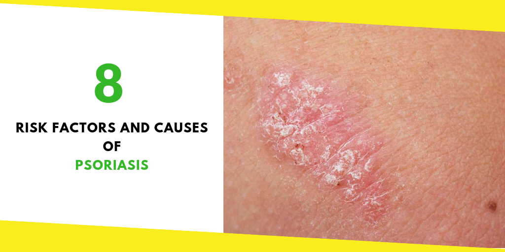 Causes of Psoriasis