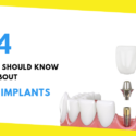4 Things You Should Know About Dental Implants
