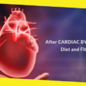After Cardiac Bypass Surgery Diet and Fitness Plan