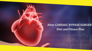 After Cardiac Bypass Surgery Diet and Fitness Plan