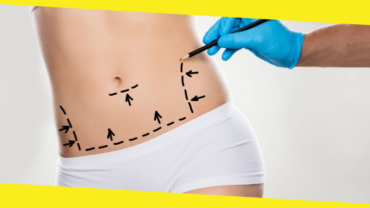 5 Myths And Facts About Tummy Tuck Surgery 