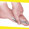 How Do I Know if I Need Arthrodesis Toe