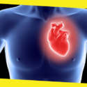 Is A Heart Transplant Recommended For You?