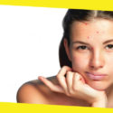 7 Must-Know Facts About Acne
