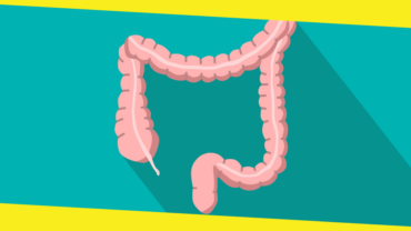 Information On Colon Cancer And The Latest Treatment Option 