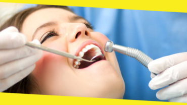 10 Myths About Root Canal Treatment