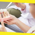 Dental Implants Singapore: The Gold Standard for Tooth Replacement