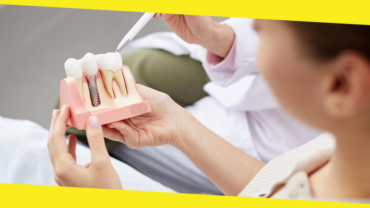 Dental Implants Singapore: The Gold Standard for Tooth Replacement