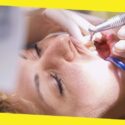 All You Need To Know About Dental Cleaning