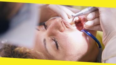 All You Need To Know About Dental Cleaning