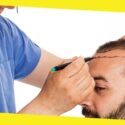 Turkey Hair Transplant – an Overview