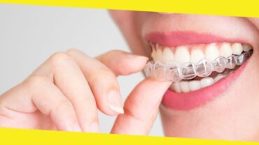 Invisalign The Coolest Dental Product