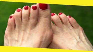 How To Handle Your Tailor’s Bunion