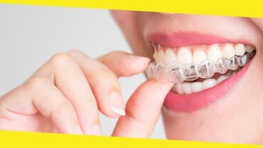 5 Factors To Look Into When Getting Invisalign In Winnipeg